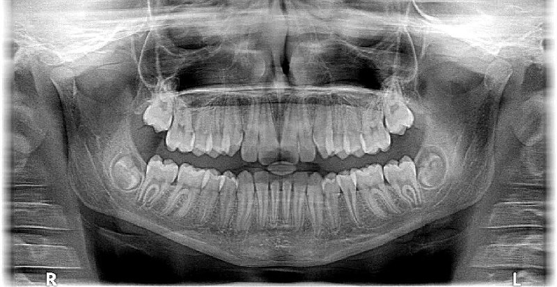 Piękno uśmiechu, pomoże ortodonta